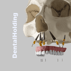 program-kursow-implantacja-all-on-x