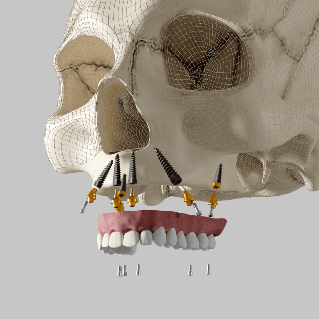 Kurs kadawerowy – implanty zygomatyczne i pterygoidalne – grafika informacyjna