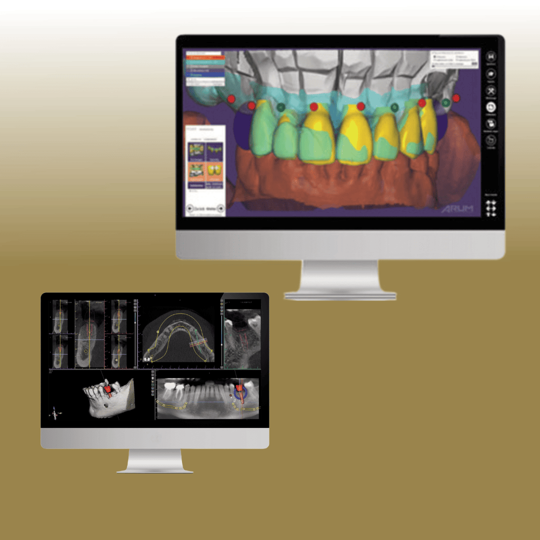Laboratorium cyfrowe oferuje usługi w pełnym zakresie z zastosowaniem najnowszych technologii stomatologii cyfrowej