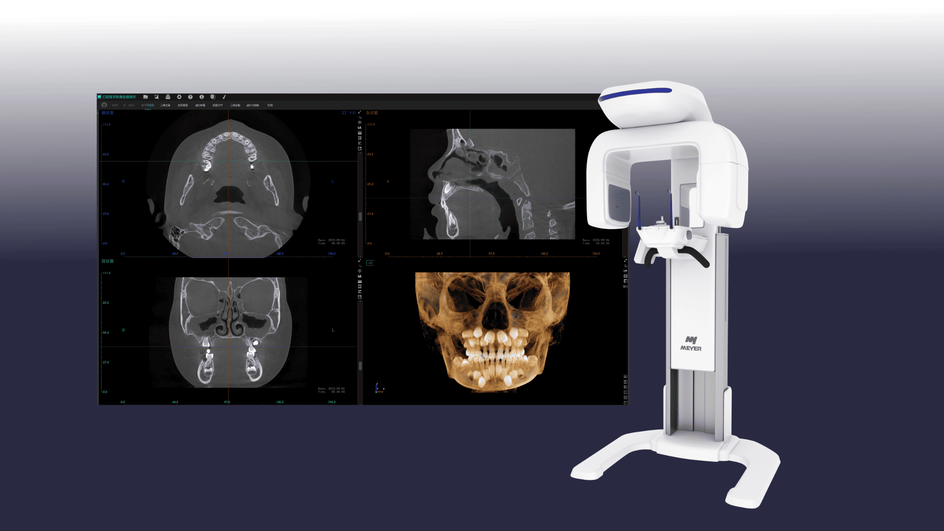 Oprogramowanie CBCT MEYER