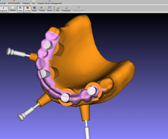 Pantomografy, 3D CBCT, rtg, radiowizjografia, unity stomatologiczne, skalery PTA, piaskarki, autoklawy, sterylizacja, skanery, implanty, biomateriały