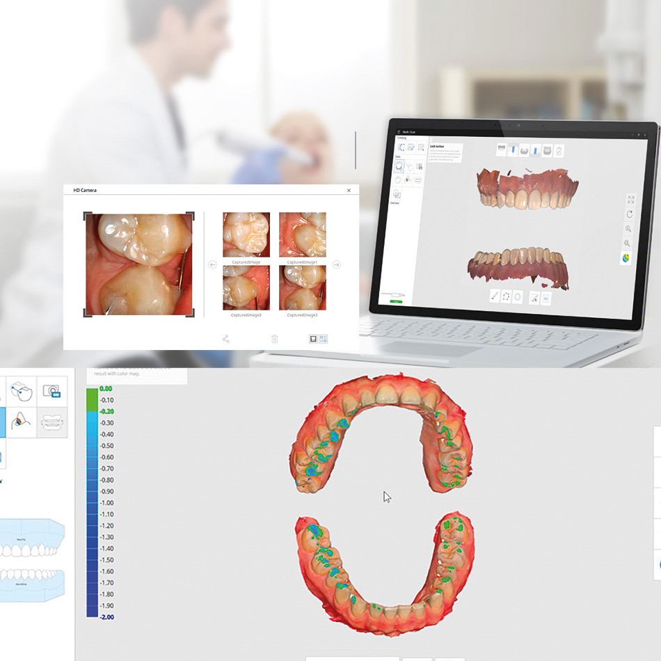 Pantomografy, 3D CBCT, rtg, radiowizjografia, unity stomatologiczne, skalery PTA, piaskarki, autoklawy, sterylizacja, skanery, implanty, biomateriały